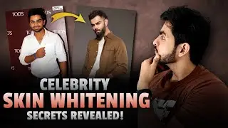 The Dark Truth Of Indian Skin Whitening Celebrities