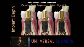 Why? From concept to reality