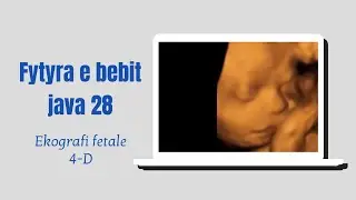 Eko fetale 4D. Bebi java 28.