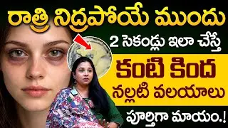 Say Goodbye to Puffy Eyes & Dark Circles Naturally | How to Remove Dark Circles Naturally | iDream