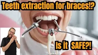 Will You Regret Removing Teeth For Braces
