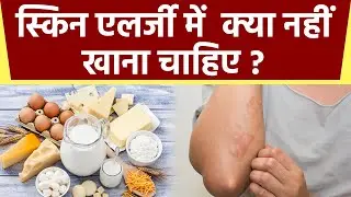 Skin Allergy होने पर नहीं खानी चाहिए ये चीजें वरना...| Boldsky