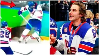 USA star Jack Hughes loses teeth after high stick from Canada Olympic hockey 2026