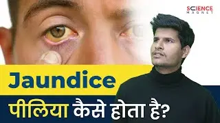 Jaundice (पीलिया) कैसे होता है? #neerajsir #sciencemagnet