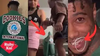 Blueface is MISSING Some Teeth‼️ Chrisean Had Blueface Jacket 👀