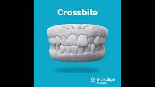 INVISALIGN | PhillyDentistry.com