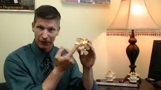 Charlotte Chiropractor - ProHealth & Wellness Chiropractic - Spinal Arthritis