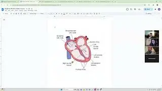 Basic ECG/EKG Telemetry focused Rhythm recognition Zoom Part 2
