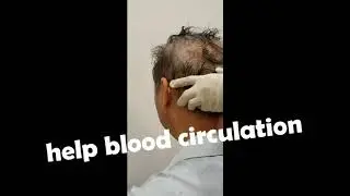 Hair massage treatment Tutorial (help blood circulation)hair massage tutorial