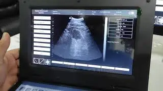ULTRASONOGRAFO CONTEC CMS600P2 PARTE 3
