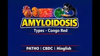 Amyloidosis in Pathology | Types, Pathogenesis & Congo Red | CBDC | Hinglish | MBBS BHMS FMG