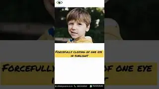 Child eye specialist in indore  | Best child eye doctor in indore  #doctor  #squintsurgery #viral