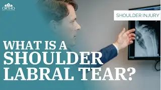 What Is A Shoulder Labral Tear?