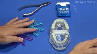 Straight Wire Orthodontics Spacers Demo
