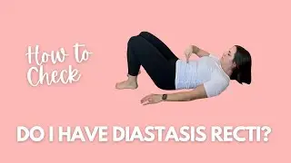 Do I Have Diastasis Recti? How to Check Yourself