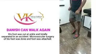 Microvascular Reconstruction of foot