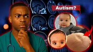 3 Baby Head Signs Parents Should Never Ignore | Doctor Explains
