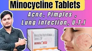 Minocycline Hydrochloride Tablets usp | Best Antibiotic For Acne & Pimples | Benifit Of Minocycline