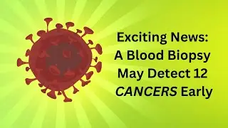 New Blood-Based Biopsy Could Spot Early-Stage Cancers, Study Finds