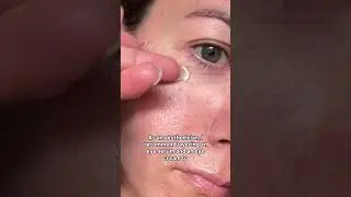 Do your undereyes betray your age??