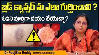 బ్లడ్ క్యాన్సర్ లక్షణాలు - చికిత్స | Early Signs of Blood Cancer in Telugu | Kaizen Oncology Network