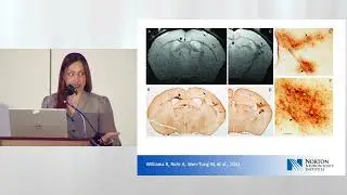 Neuroscience Expo: Aging Considerations in MS