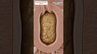 Digestive Animation of Large Cracked Stool Mass Moving with Intestinal Peristalsis #shorts