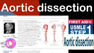 Aortic dissection in Hindi/Urdu by first aid for USMLE step 1