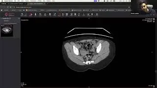 Master CT Scan of urinary track with Dr. Lasker  #radiology #ctimaging  #medicalcourse #medicaldegre