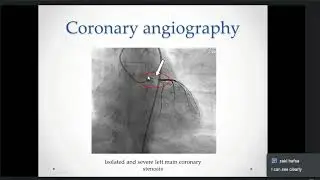 Capsule 17: Left main coronary artery disease (Coronary Emergency) | Dr. Zaki Khadija [EN]
