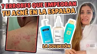 7 ERRORES COMUNES QUE EMPEORAN EL ACNÉ DE LA ESPALDA