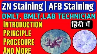 Ziehl Neelsen Staining(ZN Stain)|Acid Fast Staining(AFB Stain)|A brief Introduction and Principal