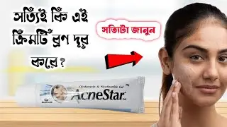 Acnestar Cream Honest Review 2025|ব্রন কমাতে এ ক্রিমটি কতটা কার্যকরী কিভাবে ব্যবহার করবেন জেনে নিন।