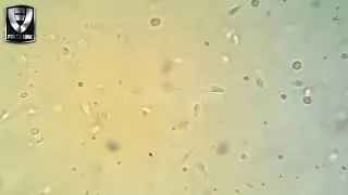 Menakjubkan! Wujud Sperma Manusia Di Perbesar 1000 x Dengan Mikroskop