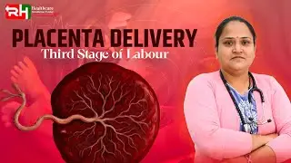 Placenta Delivery 🤰 | Third Stage of Labour Explained #PlacentaDelivery #ThirdStageOfLabour