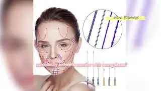 PDO screw threads#pdothread #screwthread #skintightening