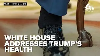 Leavitt announces Trump's diagnosis after bruised hands and swollen ankles sparked online discussion