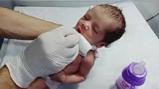 Newborn Baby Vomiting Management | NICU Care & Recovery#cutebaby #babygirl 