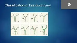Bile Duct injur and congenital anamolies by Dr Mayank General Surgery