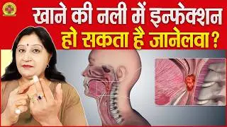 Acupressure Points For Esophagus (Food Pipe) Problem