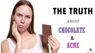 Does CHOCOLATE really cause PIMPLES?? (ACNE and DIET Part 2)