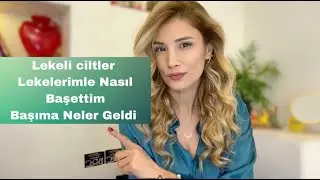 Lekerimle Nasıl Başediyorum l Neden Lekerim Oluştu l Başıma Neler Geldi #leketedavisi #ciltbakımı