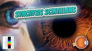 Synchysis scintillans (Your EYEBALLS) 👁️👁️💉😳💊🔊💯✅