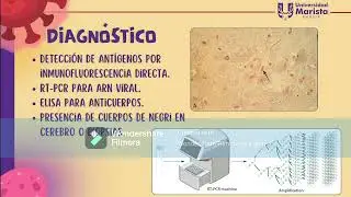 Rhabdovirus, Filovirus y Bornavirus
