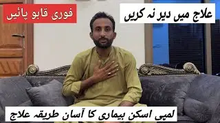 Lumpy Skin Disease Complete Successful Treatment | @MandiBoy8080 | Zeeshan khan 