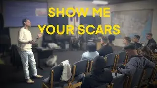 Show me your scars