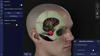 Atlas Simulation - Quick Start