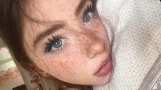 doll eyes ♡ eye enlargement surgery ꒰ঌ ໒꒱ 𖥔 ݁