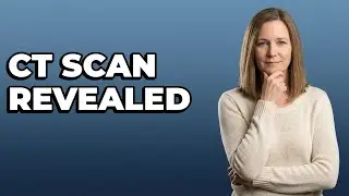 What Does A CT Scan Show With Diverticulitis?