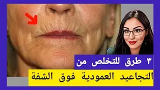 ثلاث حلول منزلية للتخلص من تجاعيد فوق الشفة